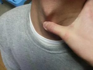 Почему растет кадык