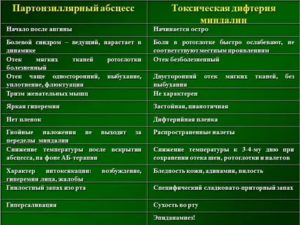 Как отличить ангину от дифтерии