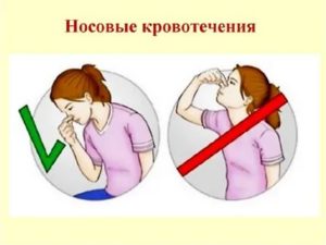 Как остановить кровь из головы