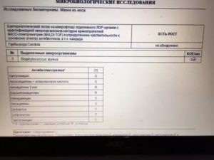 Бак посев из носоглотки