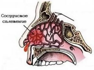 Чем укрепить сосуды в носу