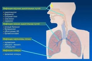 Заболевания нижних дыхательных путей