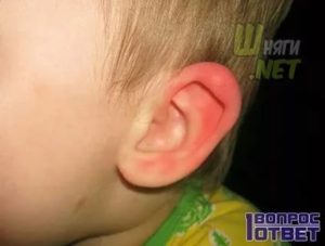 Мочка уха опухла и покраснела