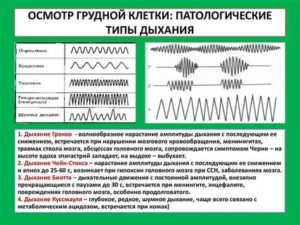 Громкое дыхание причины