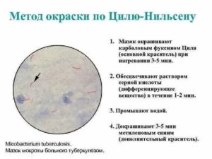 Окраска по цилю нильсену методика