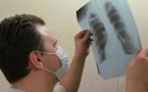 Дыхательная гимнастика при туберкулезе легких