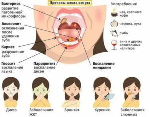 Запах гноя изо рта причины