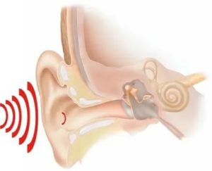 Акустическая травма уха лечение