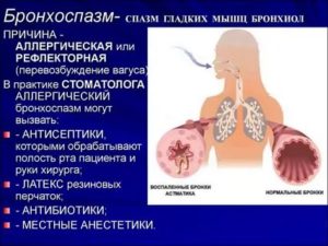 Спазм дыхательных путей симптомы