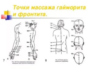 Точечный массаж при гайморите видео