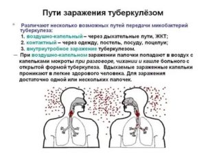 Способы заражения туберкулезом