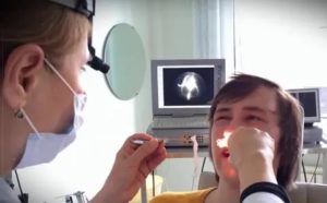 Латеропозиция нижних носовых раковин