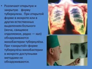 Туберкулез закрытой формы можно ли заразиться