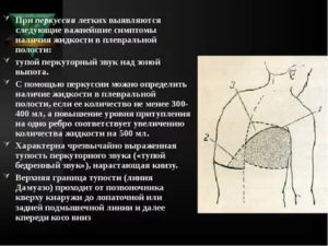 Перкуторный звук при гидротораксе