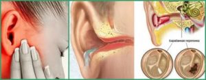 После отита плохо слышит ухо что делать