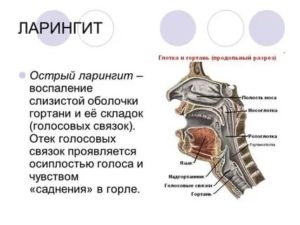 Воспаление связок горла лечение