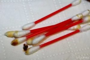 Сера в ушах коричневого цвета