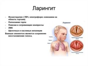 Сколько длится ларингит у детей