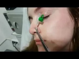 Какой нужен катетер для прокола носа