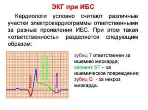 Температура при заболеваниях сердца