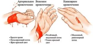 Почему долго не останавливается кровь при порезе