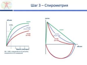 Спирограмма при бронхиальной астме