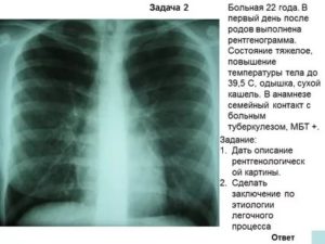 Описание рентгеновских снимков