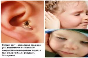 Запах из уха у ребенка комаровский