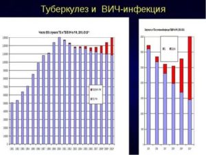 Туберкулез при вич инфекции сколько живут