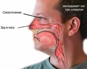 Почему закладывает нос после алкоголя