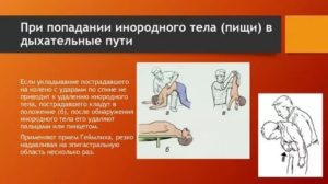 Пища попала в дыхательные пути что делать