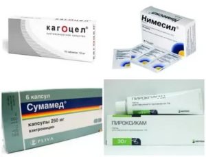 Противовоспалительные препараты при лимфадените