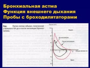 Спирограмма при бронхиальной астме