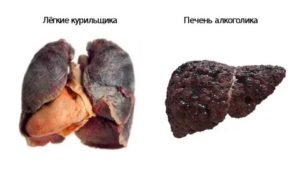 Можно ли курить после пневмонии