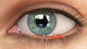 Почему в уголках глаз появляются белые выделения