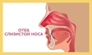 Как снять отечность носа при беременности