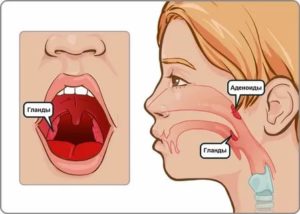 Где находятся аденоиды у человека