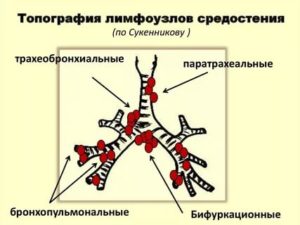 Лимфоузлы где находятся картинки