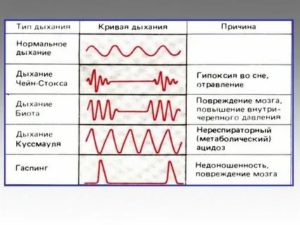 Громкое дыхание причины