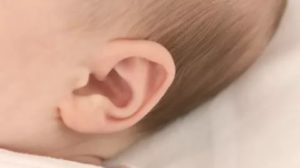 Почему ребенок теребит уши