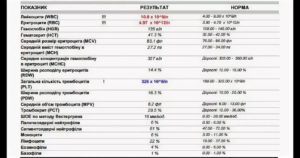 Анализ крови при ангине показатели