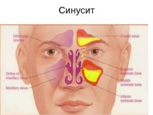 Боль под глазом около носа