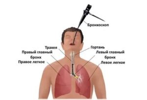 Как обследовать легкие и бронхи