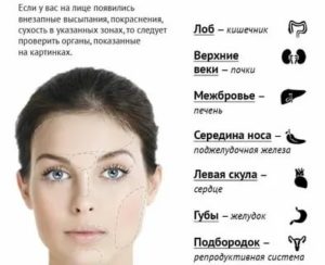 Болят скулы на лице причины