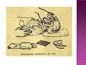 Техника постановки согревающего компресса на ухо ребенку