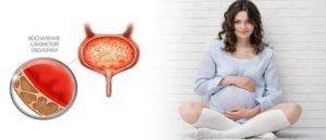 Воспаление при беременности на ранних сроках