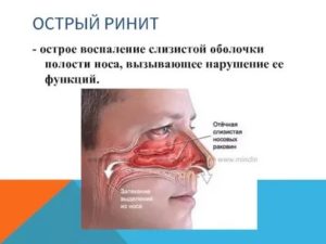 Раздражение слизистой носа лечение