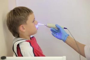 Физиотерапия при насморке у детей