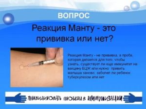 Прививка манту что нельзя делать