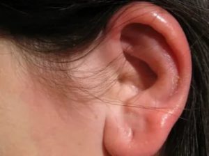 Паразиты в ушах человека симптомы